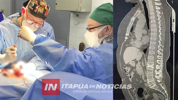 PRIMERA CIFOPLASTIA CON BALÓN EN IPS DE ENCARNACIÓN