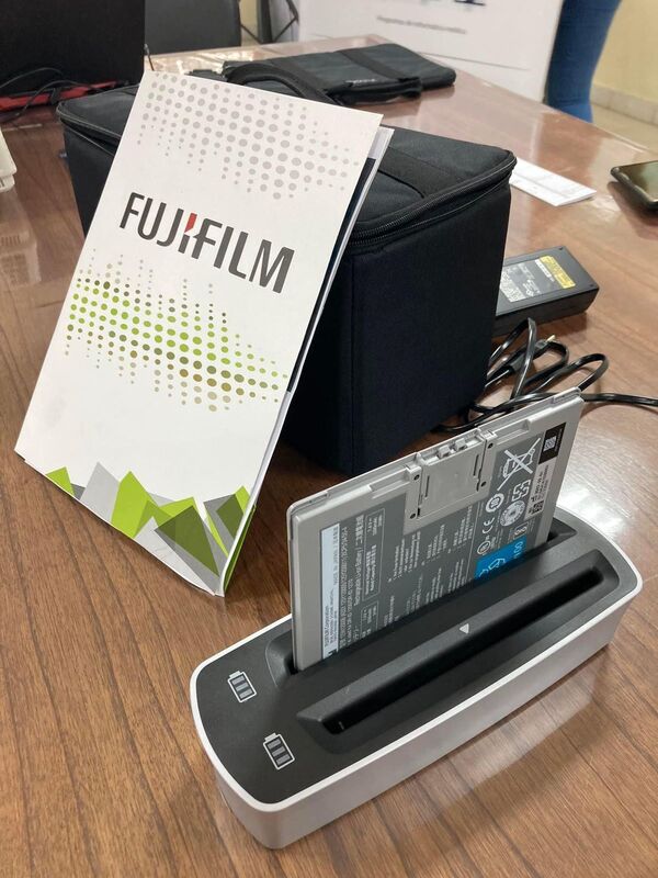 Diario HOY | Salud recibe equipo de radiografía con inteligencia artificial para tuberculosis