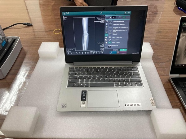 Diario HOY | Salud recibe equipo de radiografía con inteligencia artificial para tuberculosis