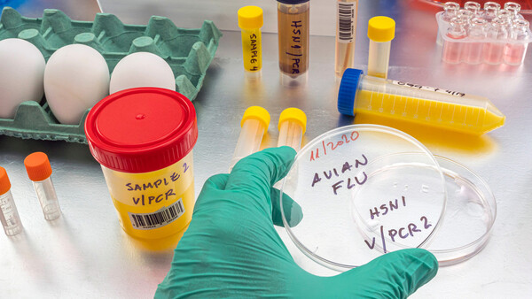 Diario HOY | Detectan en España el primer caso de gripe aviar en humanos, el segundo en Europa