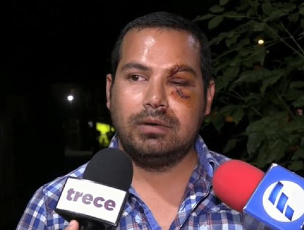 Jóvenes habrían golpeado a bombero por confrontarlos por ingresar a su propiedad · Radio Monumental 1080 AM