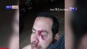 Lambaré: Hombre casi pierde la vista a causa de salvaje agresión | Noticias Paraguay