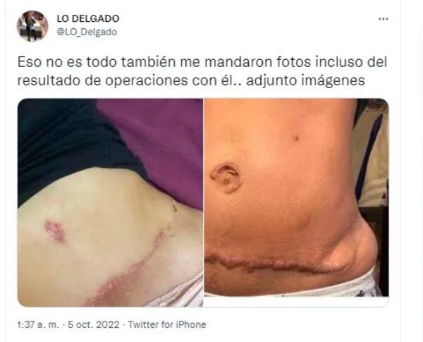 Llueven denuncias contra cirujano plástico - Nacionales - ABC Color