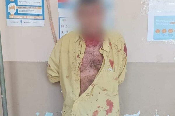 Asesinó a su hermano y cuñada a cuchillazos e hirió a su sobrino