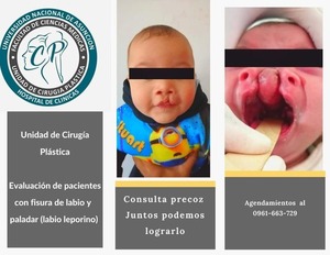 Ofrecen cirugías gratuitas para niños con labio y paladar hendido en Clínicas | 1000 Noticias