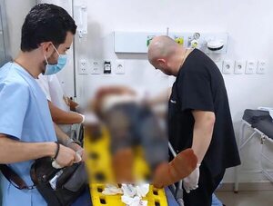 Encuentran herido al cómplice del presunto motochorro abatido - ABC en el Este - ABC Color