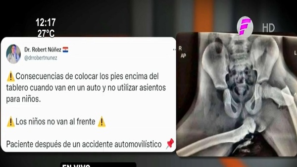 ¡Atención! Recuerdan que niños no deben viajar en asientos delanteros | Noticias Paraguay