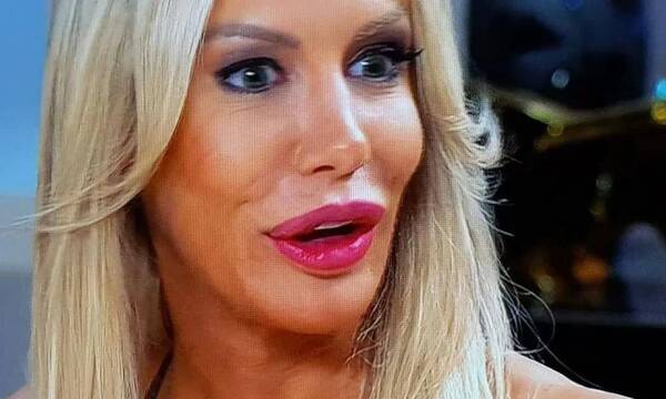 Crónica / ¡Se jugó todito! Critican a modelo por los retoques en su rostro