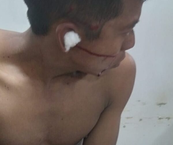 Pelea entre indígenas termina con un herido