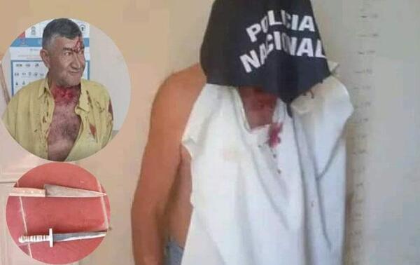 Doble homicidio en San José de los Arroyos: Mujer recibió 31 puñaladas y su pareja 4 – Prensa 5