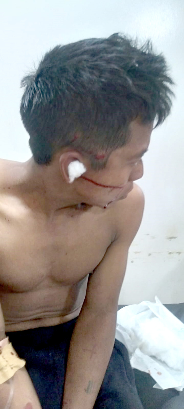 Nativo oikutupaite a su rapicha indígena tras una pelea callejera y se dio a la fuga - La Clave