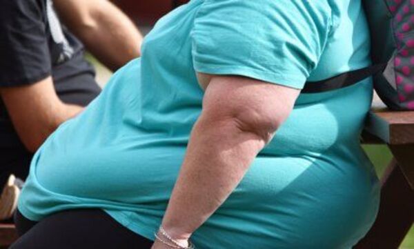Unas 2.600 muertes por año en Paraguay están relacionadas a la obesidad