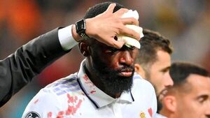 Rüdiger no sufre lesión ósea
