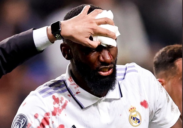 Rüdiger acaba con la cabeza partida al darle un empate al Madrid - La Prensa Futbolera