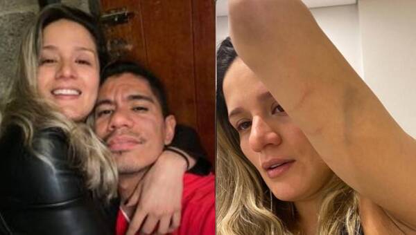 Crónica / Denunció al pelotero Rodolfo Gamarra por violencia doméstica