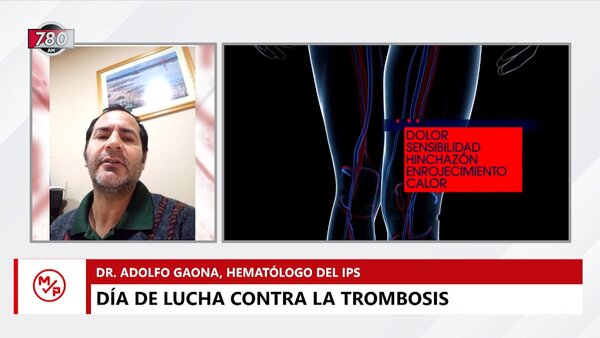 Día Mundial contra la Trombosis: ¿Cuáles son las principales causas y cómo prevenir? - Megacadena — Últimas Noticias de Paraguay
