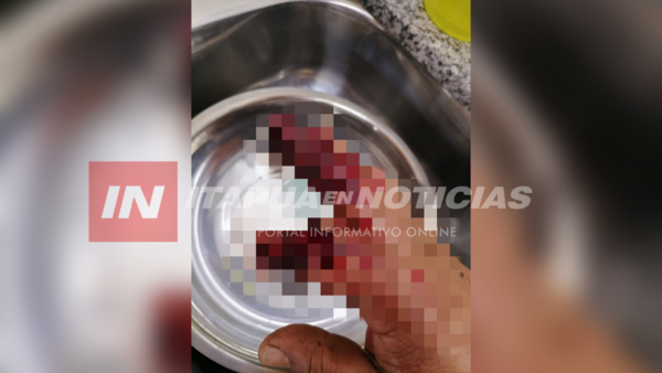 HOMBRE CASI PIERDE EL DEDO TRAS RIÑA