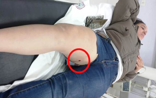 Una joven se resistió a un asalto y fue baleada por motochorros •