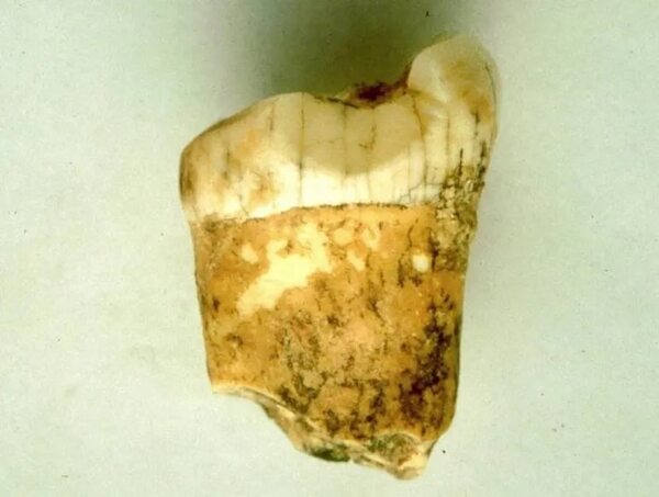 Nuevas técnicas demuestran que los neandertales fueron carnívoros - Ciencia - ABC Color
