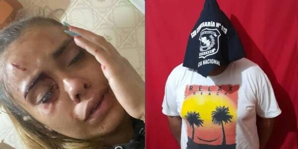 Crónica / Detuvieron al supuesto garrotero de bailarina