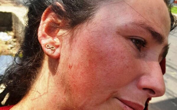 Luque: ¡Embarazada fue reventada a patadas por otras tres mujeres!