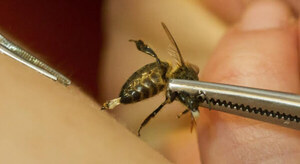 Enjambre de abejas atacó a un adolescente y en el hospital de San Pedro le salvaron la vida - Noticiero Paraguay