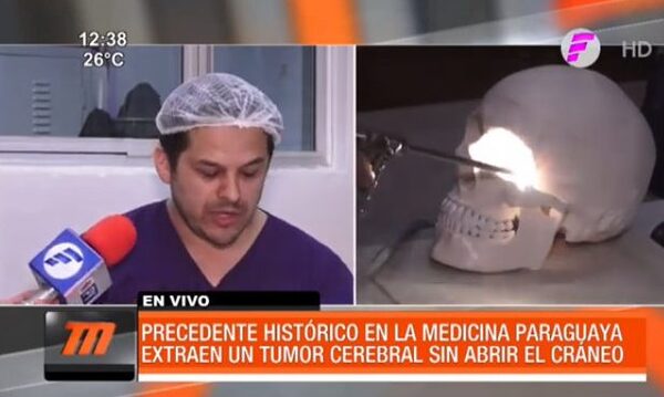 Extraen tumor cerebral sin abrir el cráneo en IPS | Telefuturo
