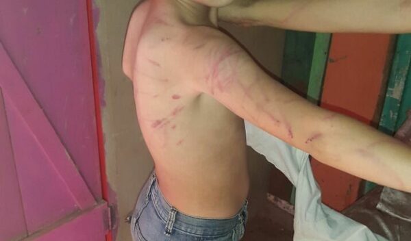 Quiso “corregir” a golpes a niño de 9 años, lo dejó en terapia intensiva