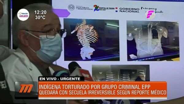 Indígena herido por el EPP tiene daños irreversibles en la columna