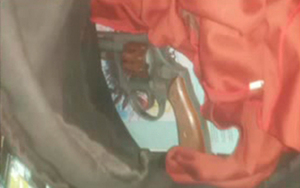 Le disparó a su compañera en el rostro - SNT