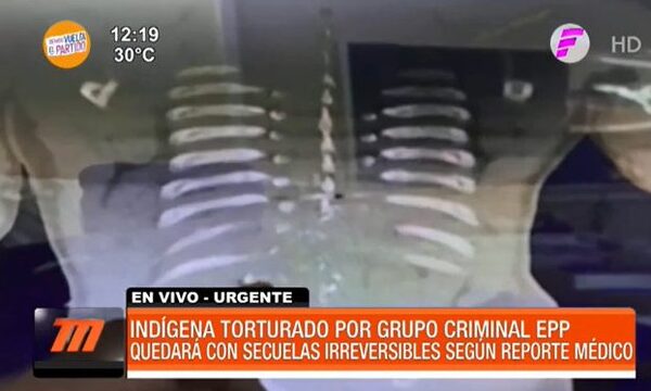 Indígena torturado por grupo criminal quedará con secuelas irreversibles - Paraguaype.com