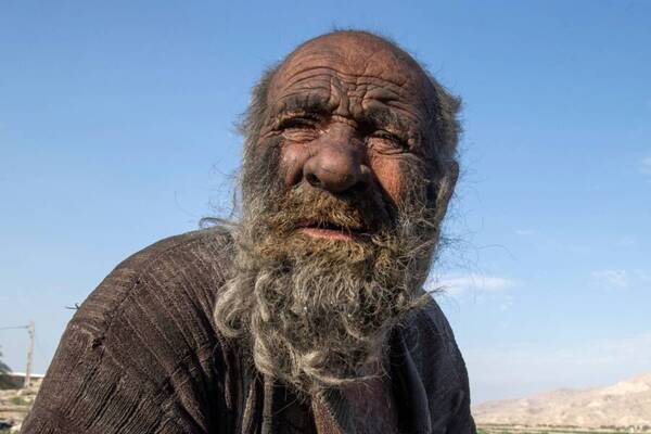 Diario HOY | El hombre más sucio del mundo fallece a los 94 años