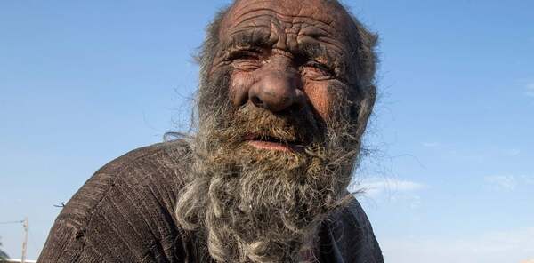 El hombre más sucio del mundo se baña por primera vez en 60 años y muere a las pocas semanas