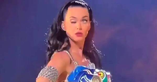 La Nación / ¿Verdad o truco?: Katy Perry cuenta sobre su párpado caído