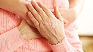 Especialistas buscan concientizar a la población sobre la psoriasis