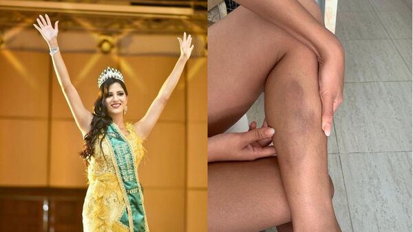 Paraguaya ganó corona internacional luego de ser agredida