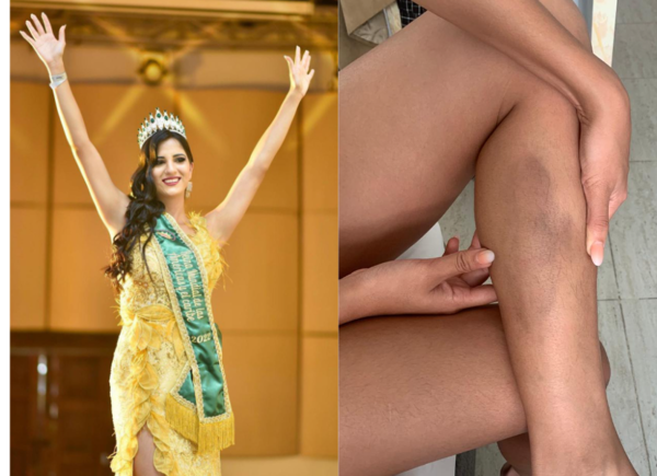 ¡Paraguaya ganó corona internacional y le patotearon para intentar sabotear su coronación!