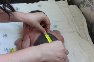 Diario HOY | Control de manchas y lunares a niños y adultos, este jueves en el hospital Acosta Ñu