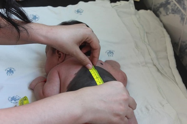 Diario HOY | Control de manchas y lunares a niños y adultos, este jueves en el hospital Acosta Ñu