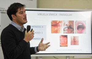 Viruela símica: 5 casos confirmados y más de 70 descartados en Paraguay