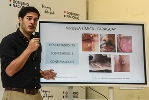 Diario HOY | Virus símica: circulación ya es comunitaria, informan