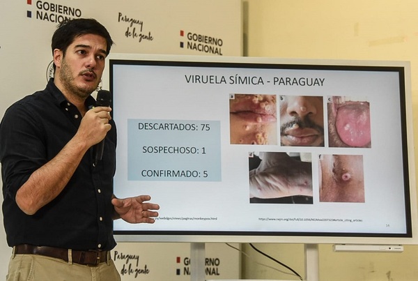 Diario HOY | Virus símica: circulación ya es comunitaria, informan