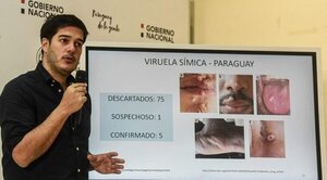 Virus símica: circulación ya es comunitaria, informan - Radio Imperio