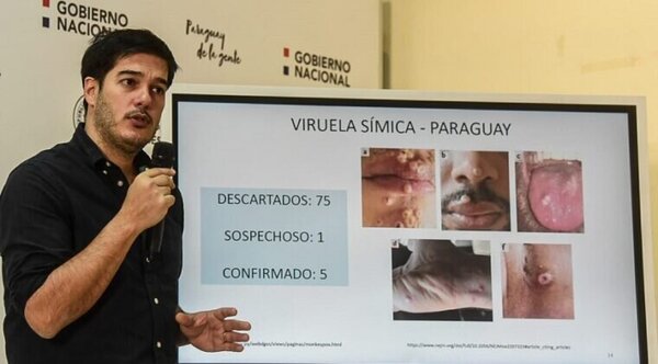 Virus símica: circulación ya es comunitaria, informan - Radio Imperio