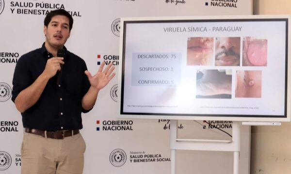 Viruela símica: Paraguay es el país de la región con menor índice de casos positivos – Diario TNPRESS