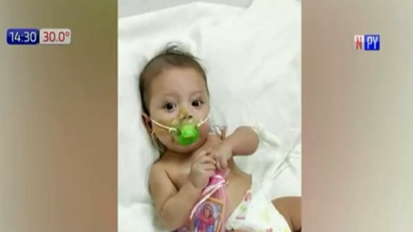 ¡Todos por Thiaguito! El pequeño tiene una compleja enfermedad y nos necesita - Paraguaype.com