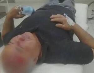 Crónica / Un paciente del neuro hirió a enfermero con maquinita de afeitar