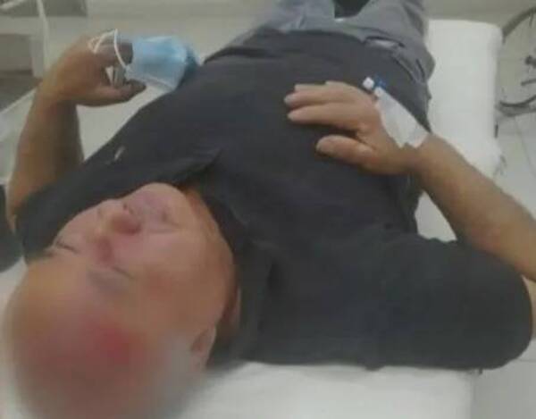 Crónica / Un paciente del neuro hirió a enfermero con maquinita de afeitar