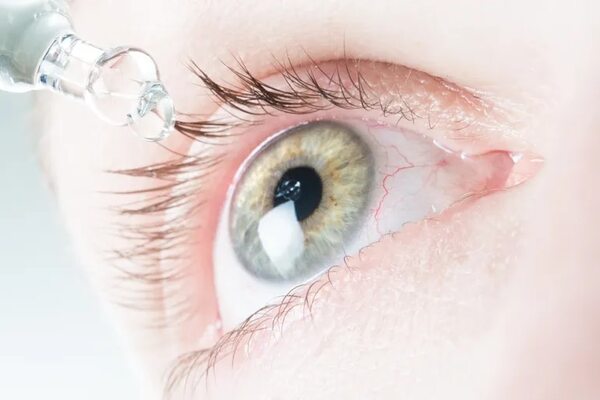 Ojo rojos: ¿son peligrosas las venas reventadas? - Estilo de vida - ABC Color
