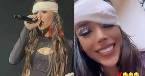 La Nación / Danna Paola terminó vendada en primera noche de su nueva gira
